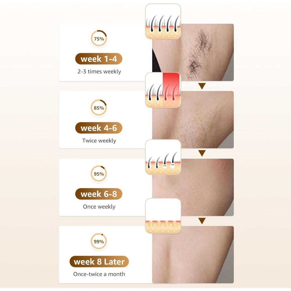 Ipl Laser Hair Removal Device with Painless Care Function White - Picture 3 of 6